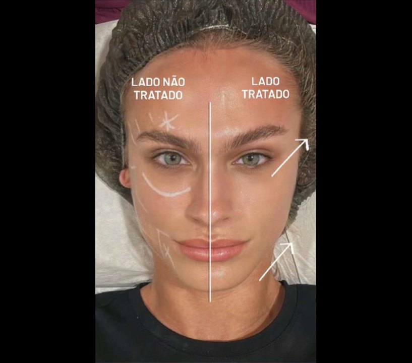 Comparativo — lado tratado e não tratado
